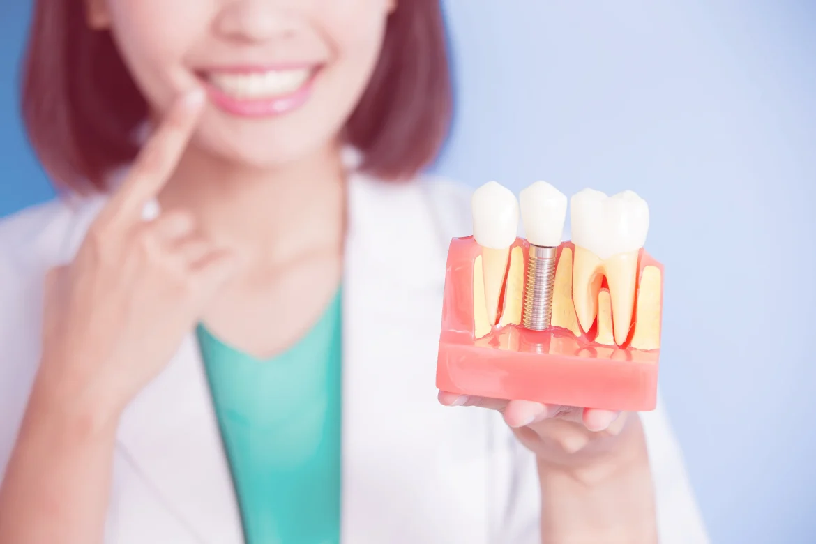 Dental Implants & its Cost