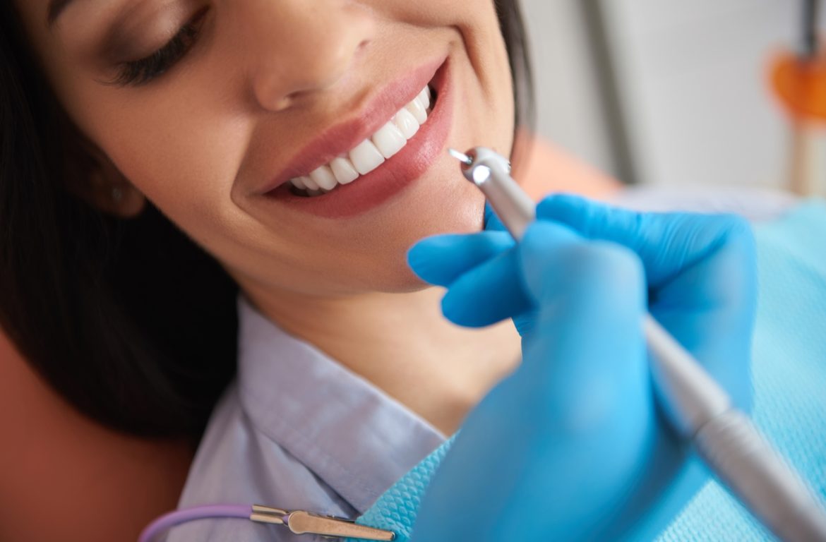 Types of Dental Cleanings