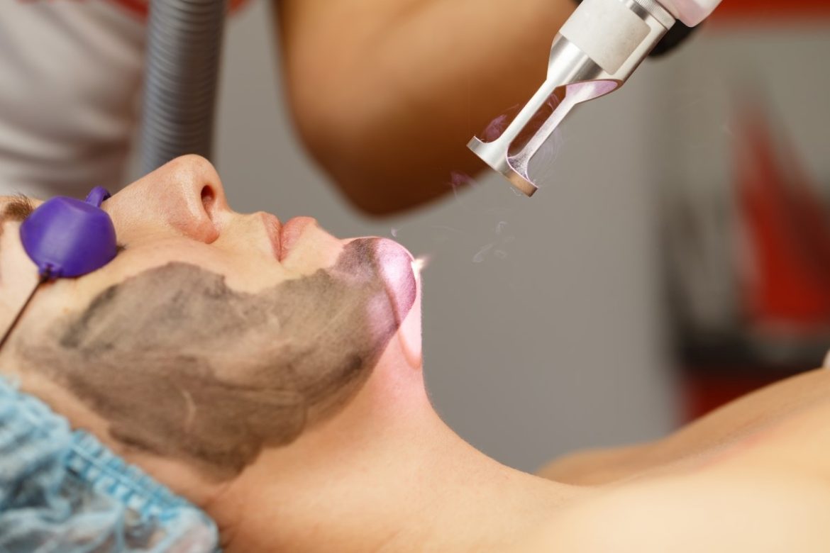 Carbon Peel Treatment in Dubai